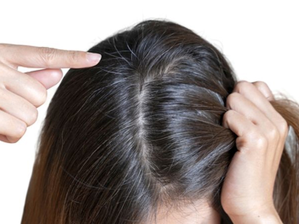 Rambut Beruban