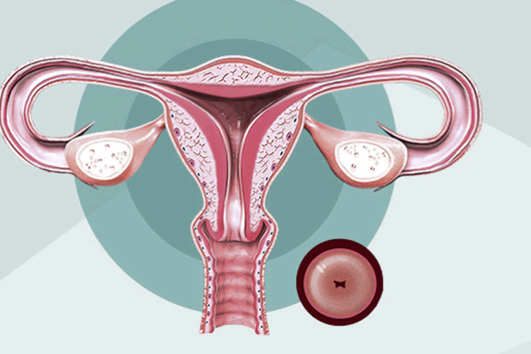Ilustrasi Serviks